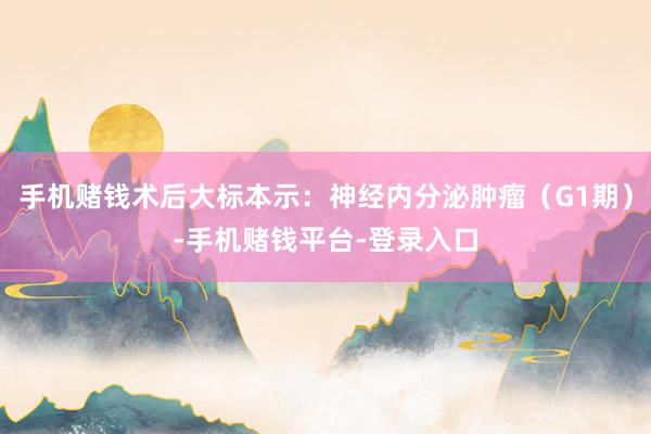 手机赌钱术后大标本示：神经内分泌肿瘤（G1期）-手机赌钱平台-登录入口